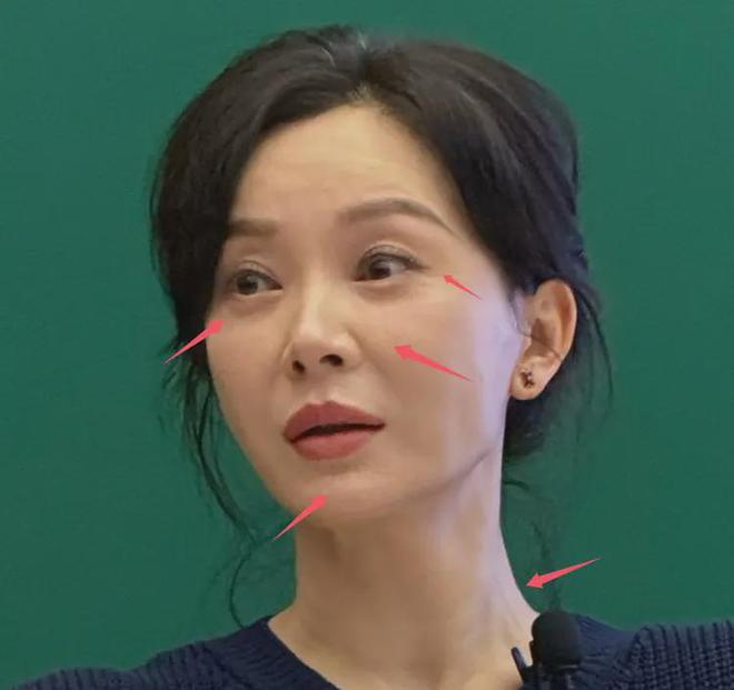 苹果肌凸起还卡粉两任丈夫都出轨！AG旗舰厅47岁陈数中戏上课生图