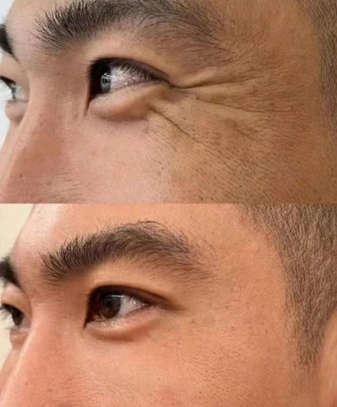 护肤品推荐这几款口碑不可错过AG旗舰厅娱乐平台抗皱紧致的(图2)