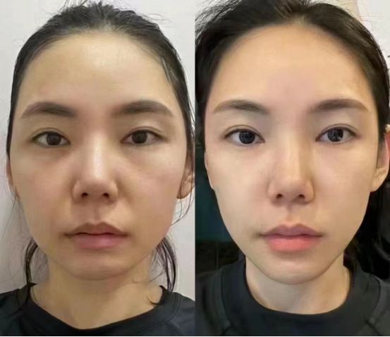 2024最值得入手的抗皱国货分享AG旗舰厅抗老去皱纹护肤品推荐(图5)
