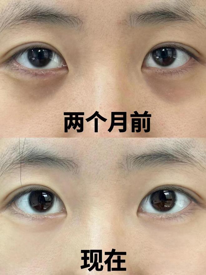 效果最好？别太会挑十款实力很强的眼霜AG旗舰厅平台眼霜哪个牌子抗皱去皱(图11)