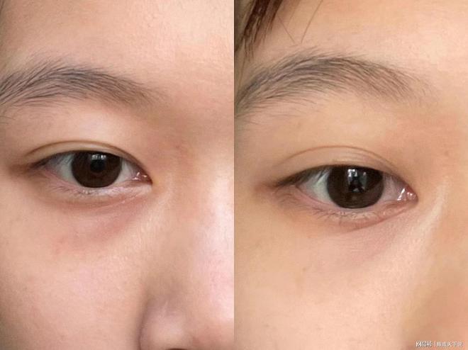？推荐六款眼霜全方位改善眼周肌肤AG旗舰厅首页什么眼霜去皱效果好(图7)